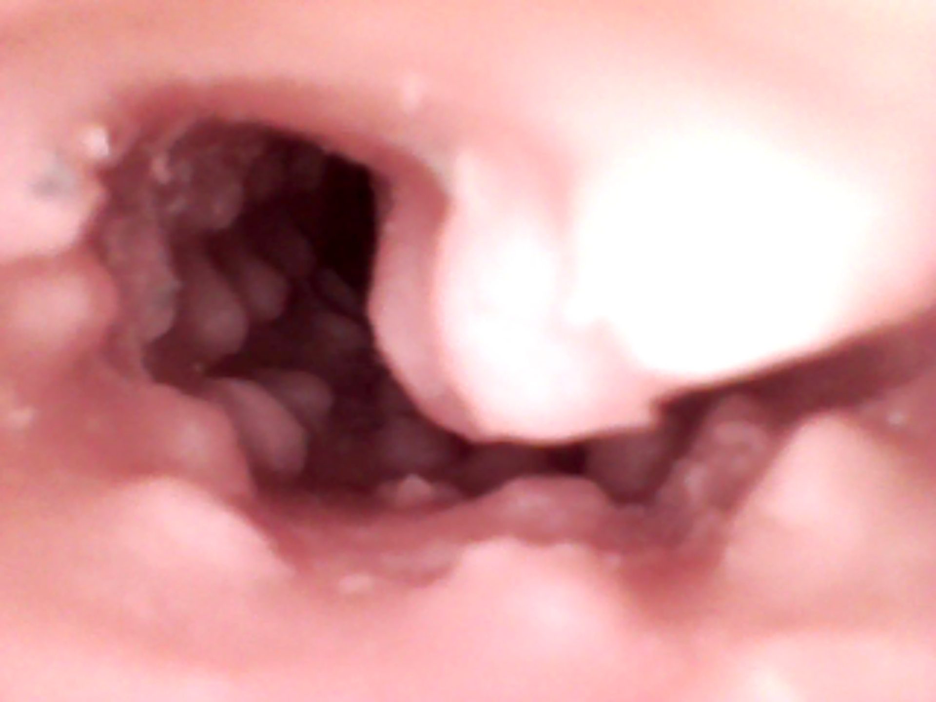 vag (2).JPG