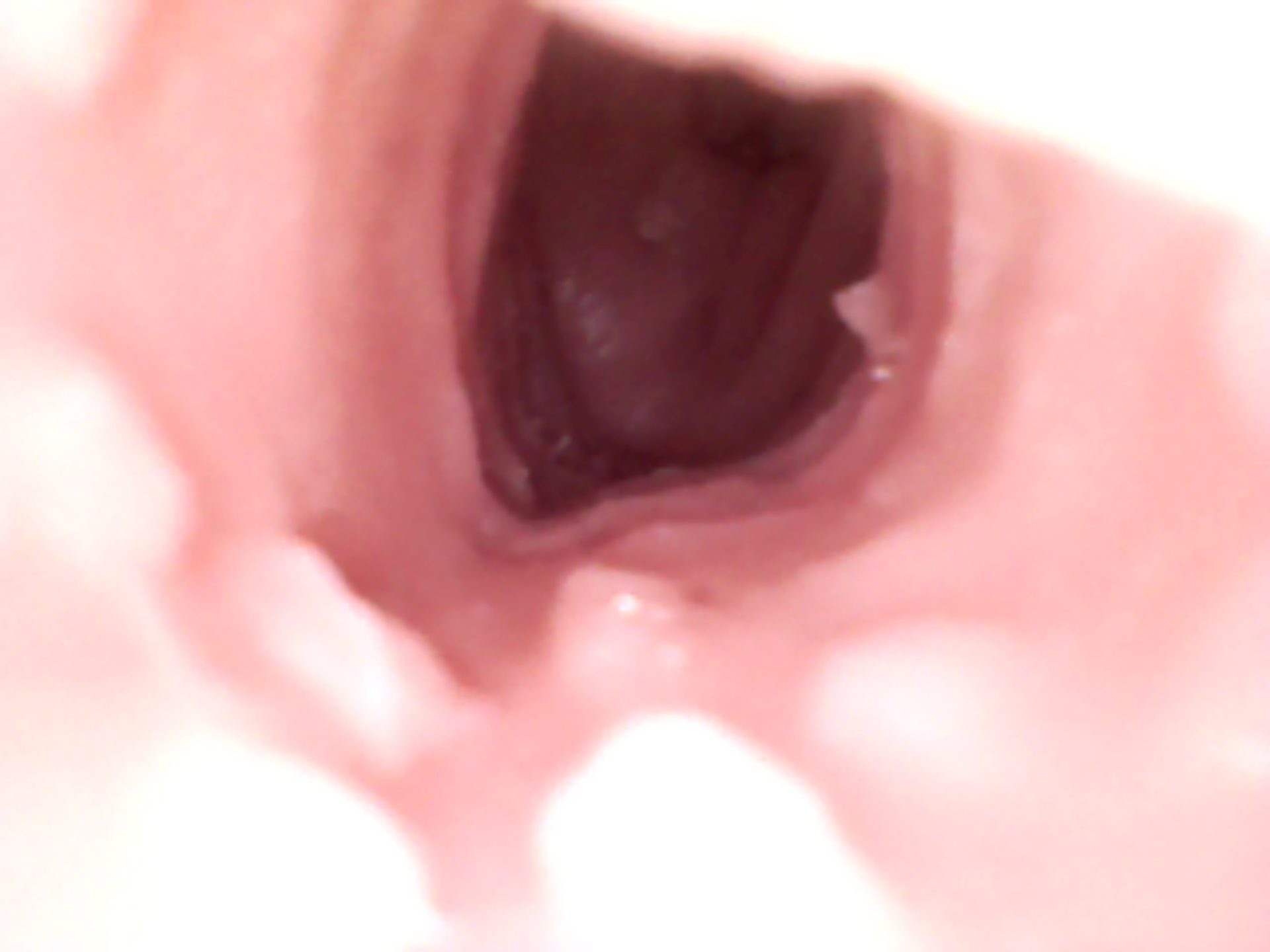vag (3).JPG