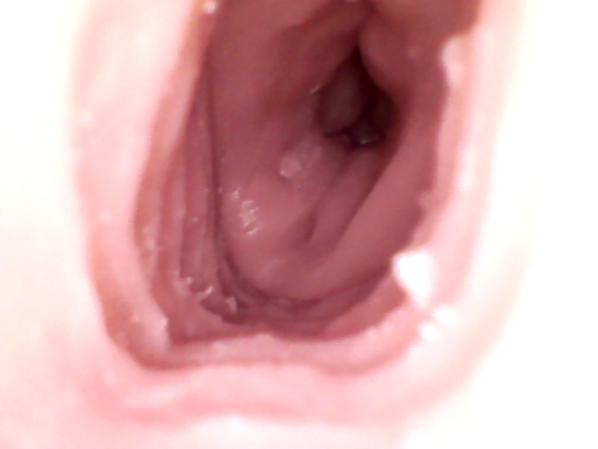 vag (4).JPG