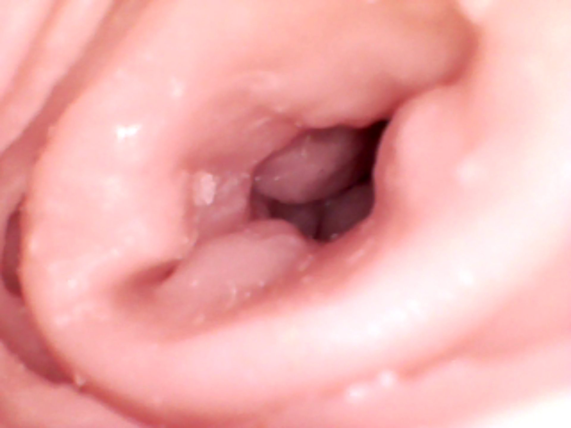 vag (6).JPG