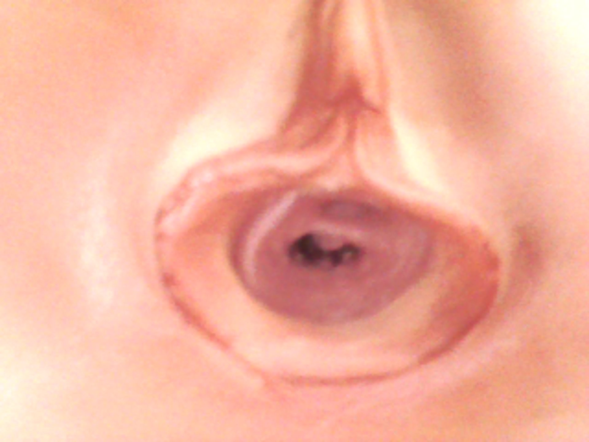 vag (8).JPG