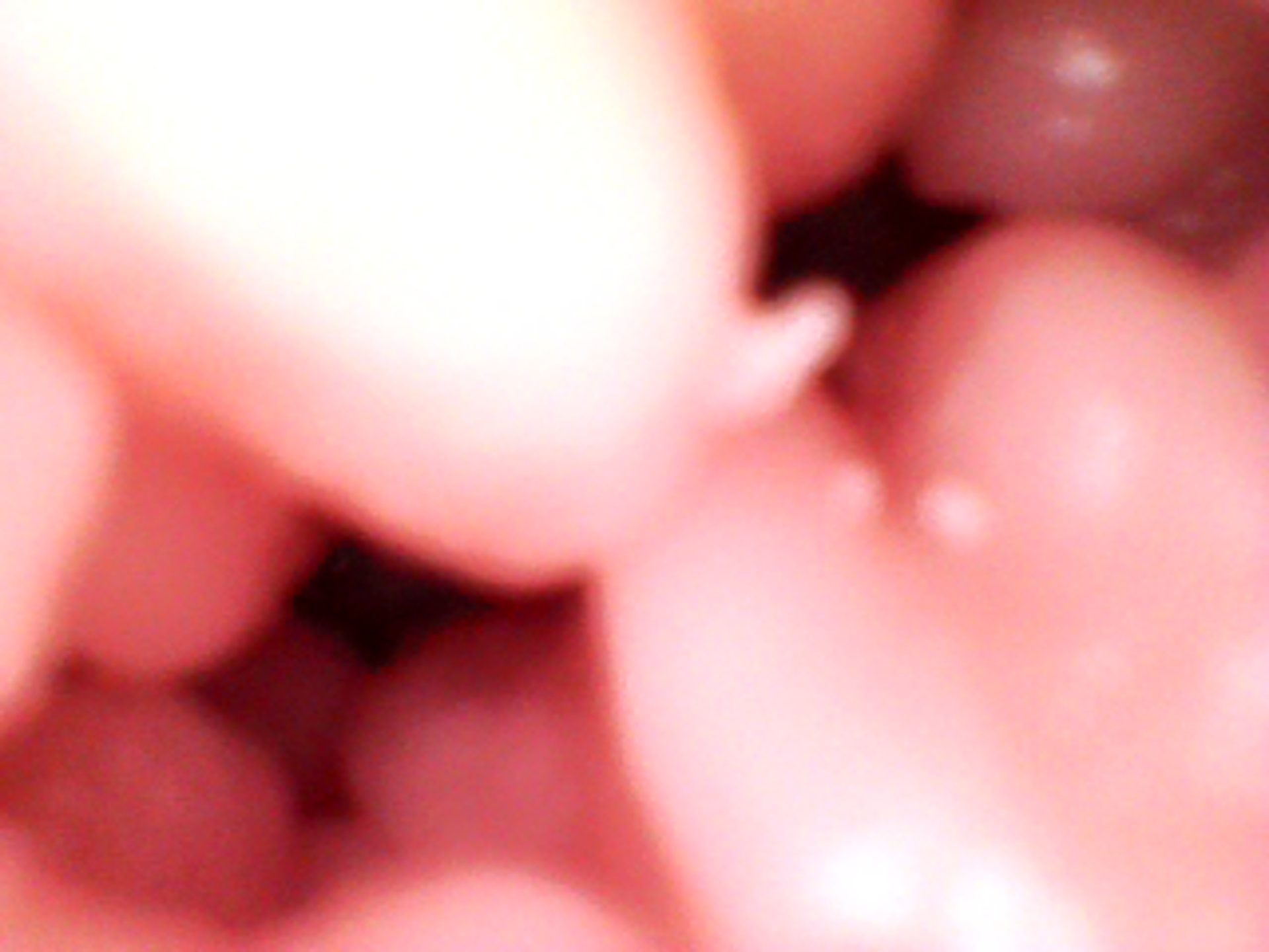 anal (4).JPG