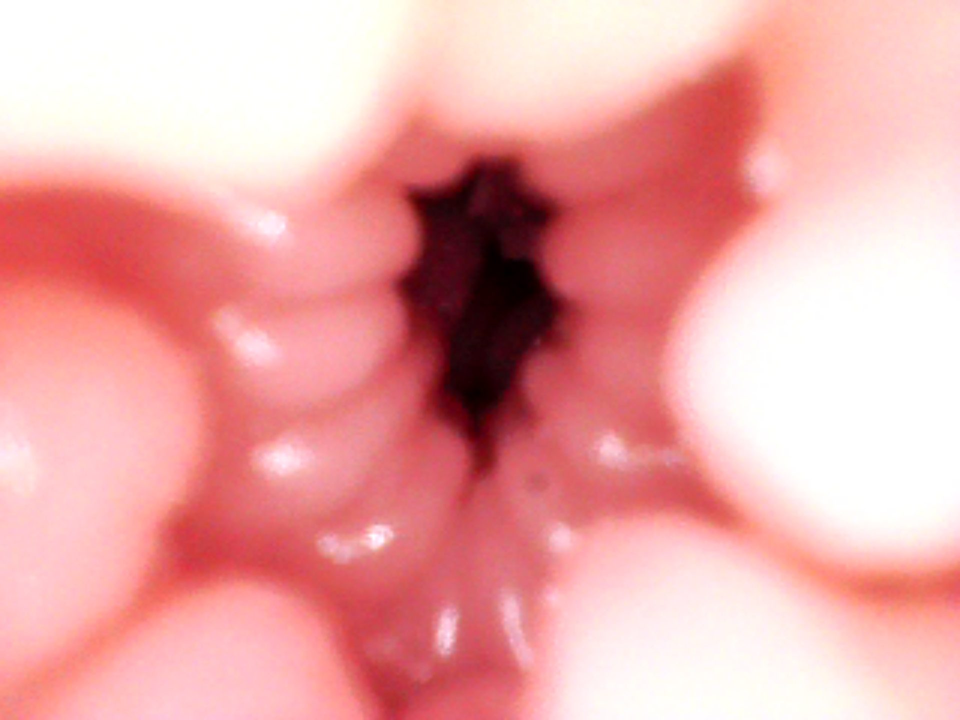 anal (5).JPG