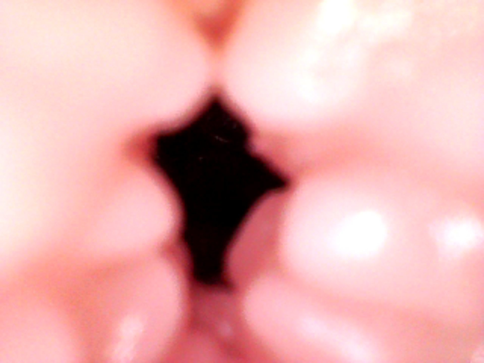 anal (6).JPG
