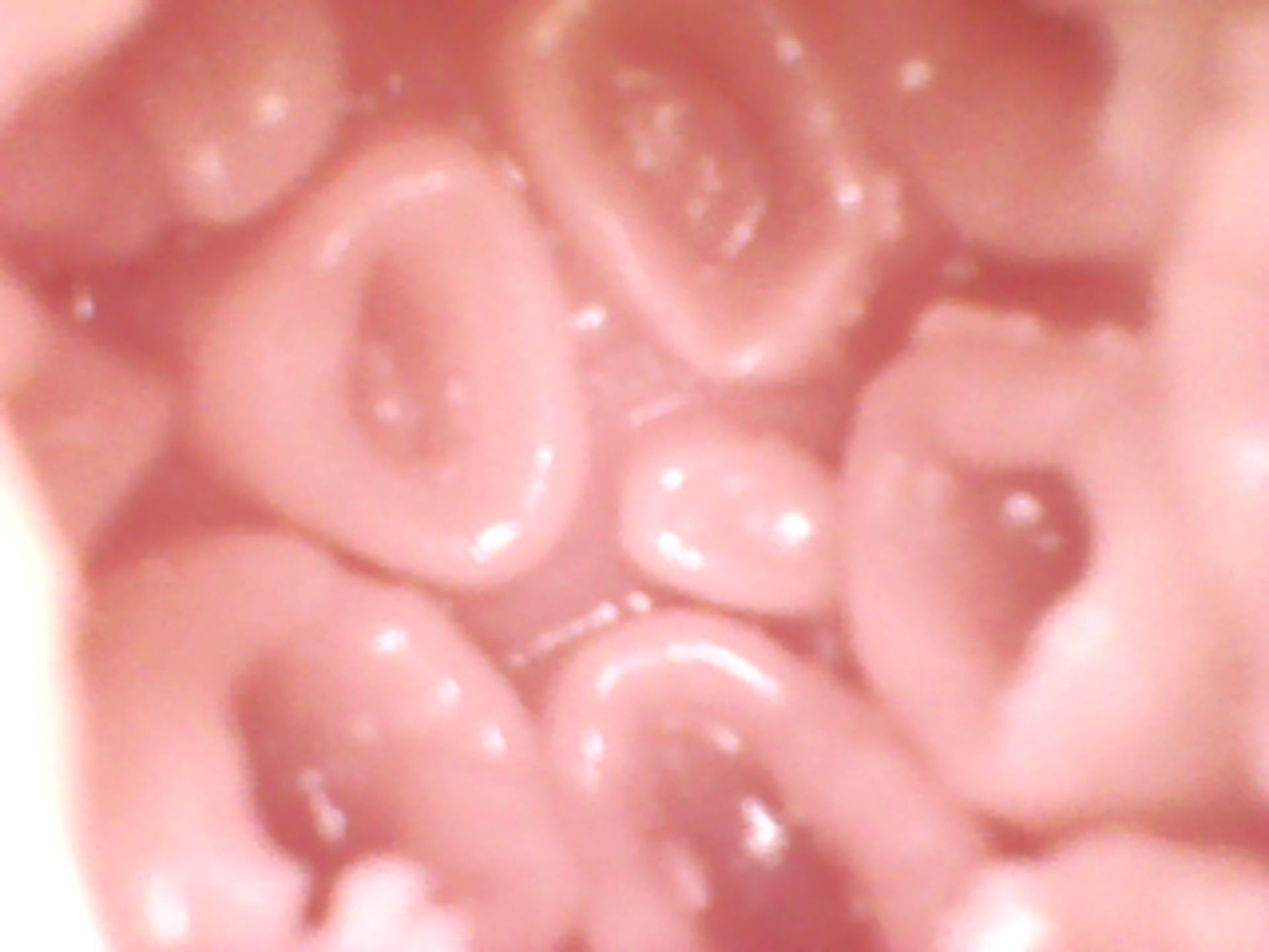 anal (7).JPG