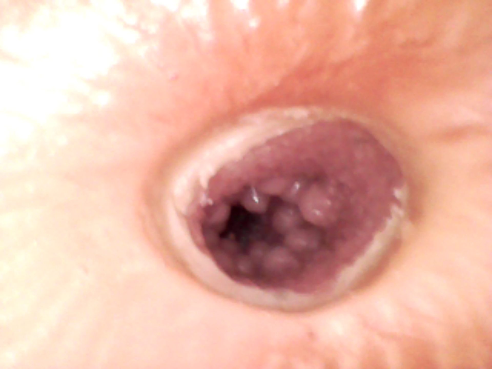 anal (8).JPG