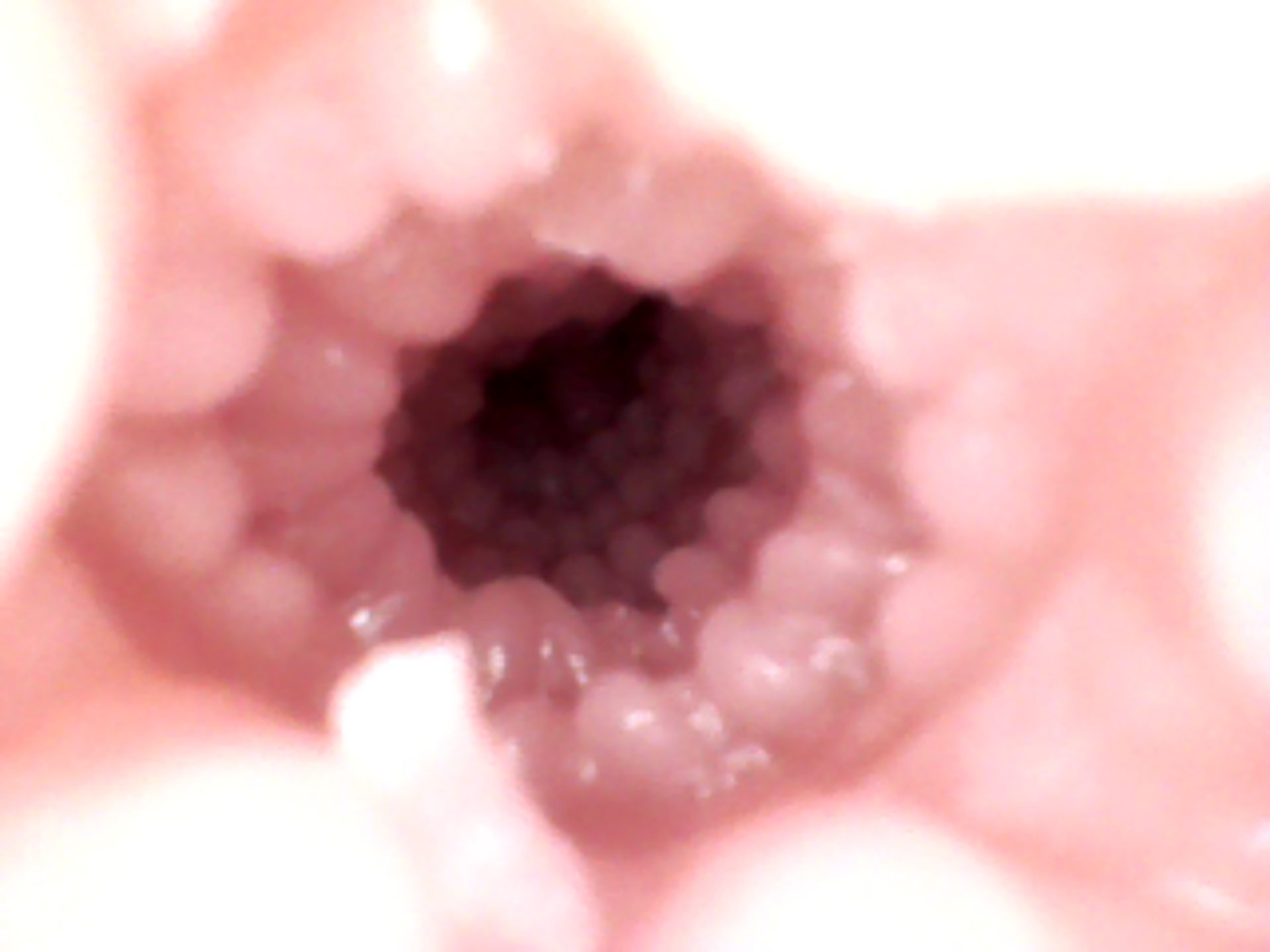 anal (2).JPG