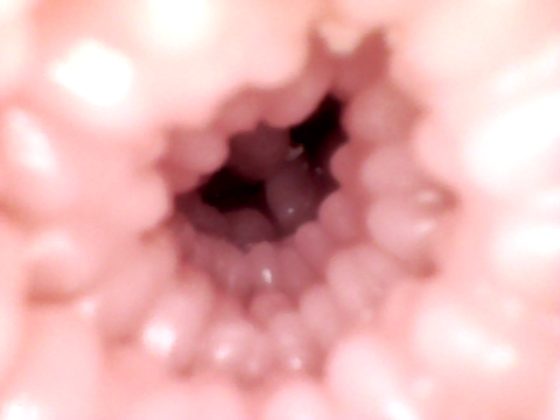 anal (3).JPG